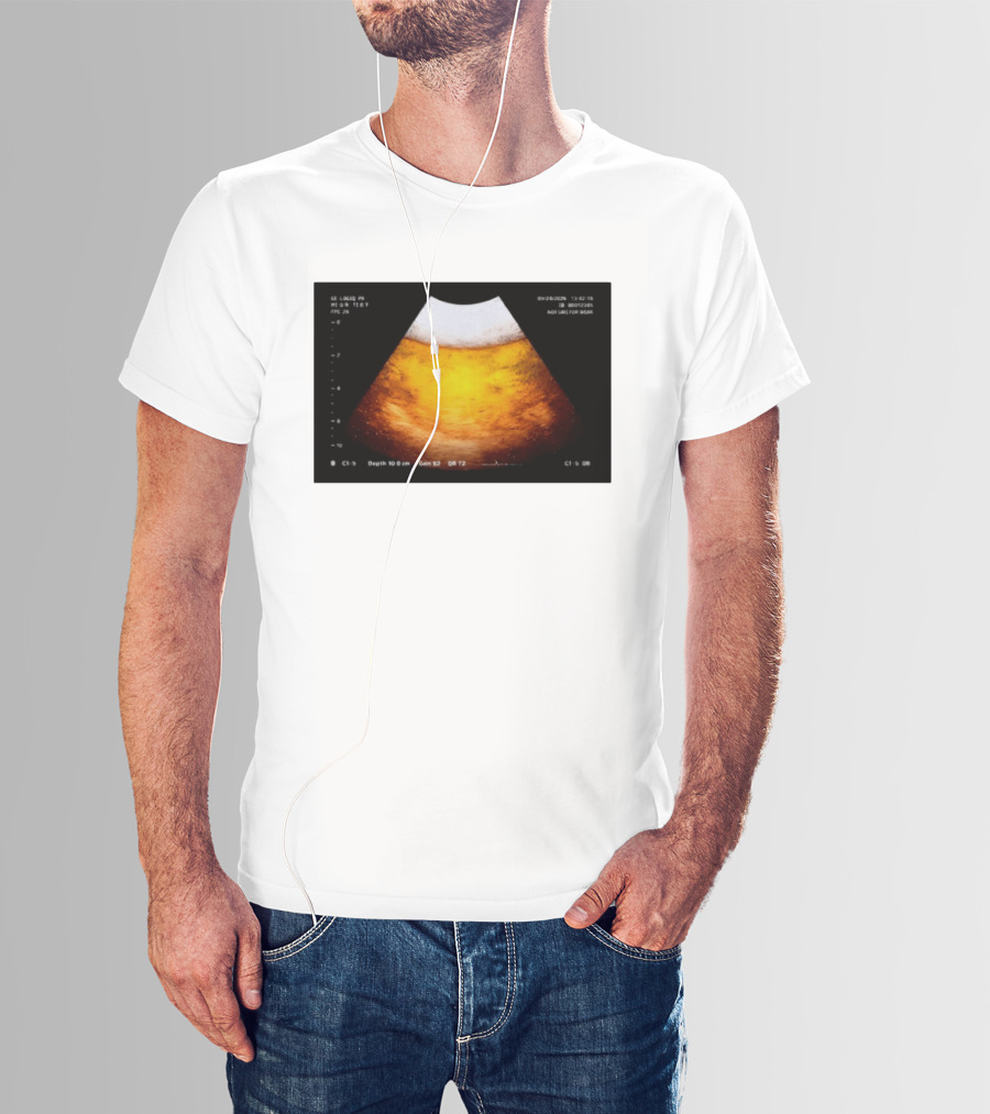 Beer Ultrasound Image Not Safe For Liver T-Shirt